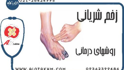 زخم شریانی