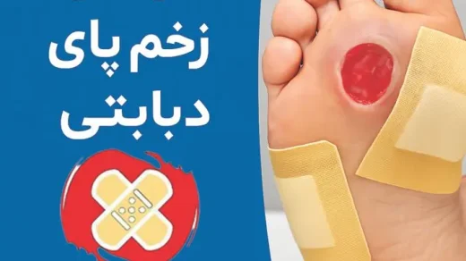 درمان زخم پای دیابتی